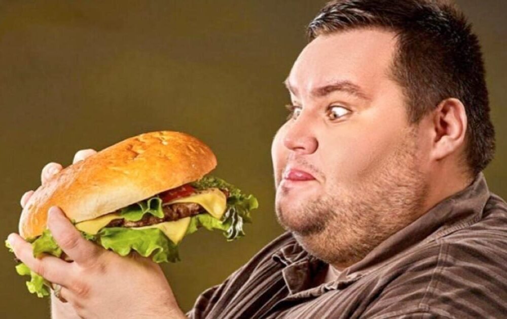 obezite-nedir-nasil-tedavi-edilir Obezite Nedir? Nasıl Tedavi Edilir?