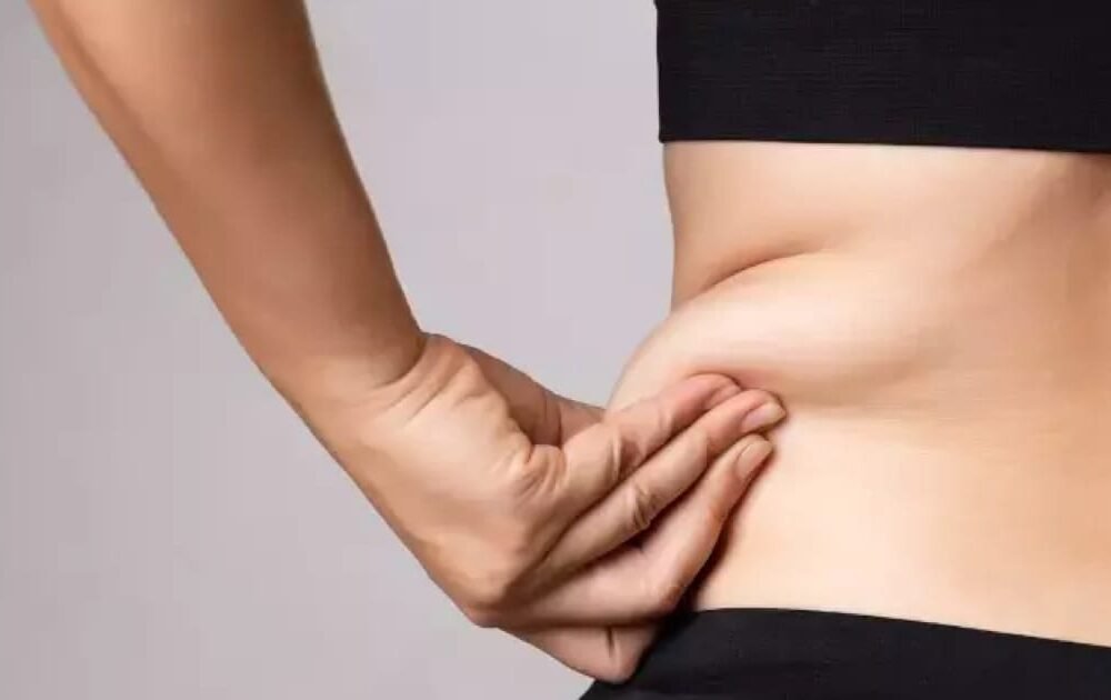 obezite-ameliyati-sonrasi-sarkma-nasil-engellenir Obezite Ameliyatı Sonrası Sarkma Nasıl Engellenir?