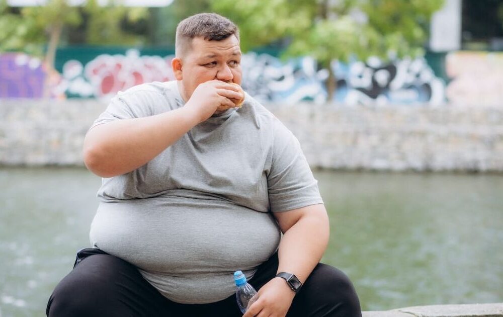 Çağımızın Hastalığı Obeziteye Cerrahi Çözüm